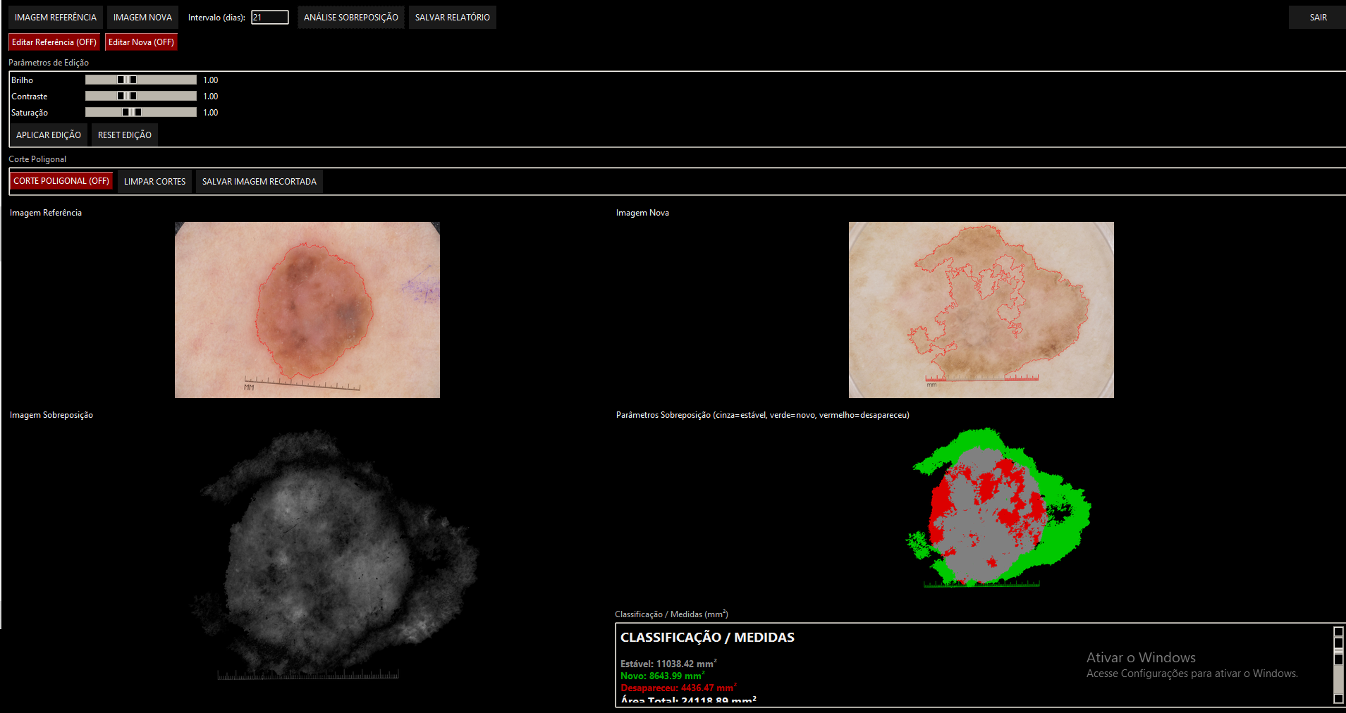 Tela da rotina de análise estática comparativa de manchas em diferentes períodos