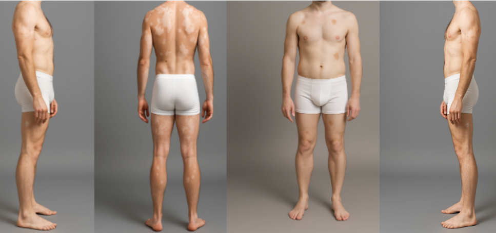 Fotos em alta resolução de corpo inteiro com marcação manual de manchas